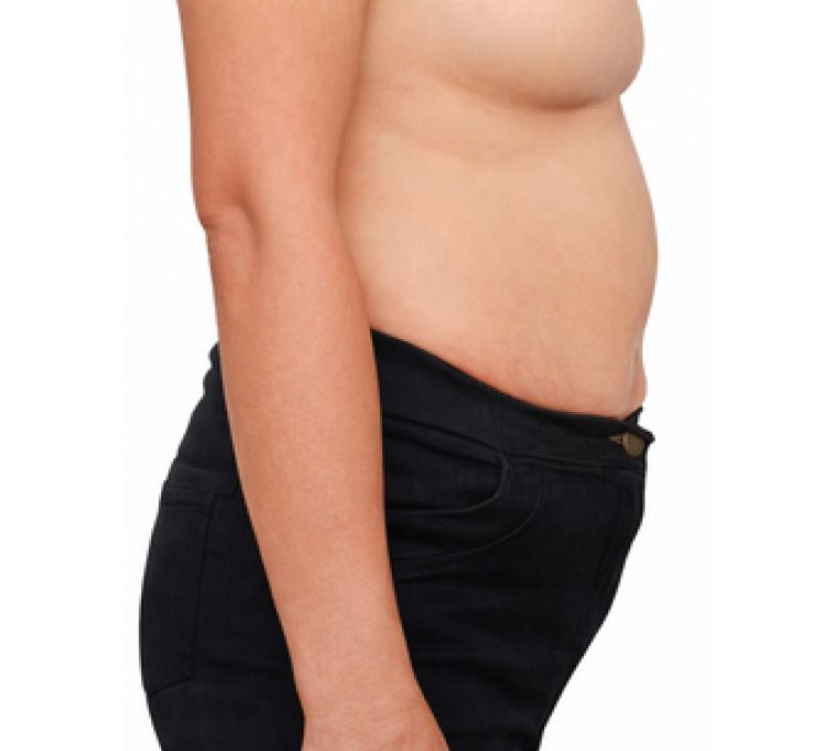 body-treat-8-bfr